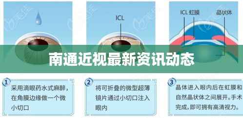 南通近视最新资讯动态